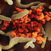 Coronavirus photo